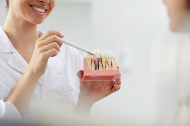 Dental implants nyc