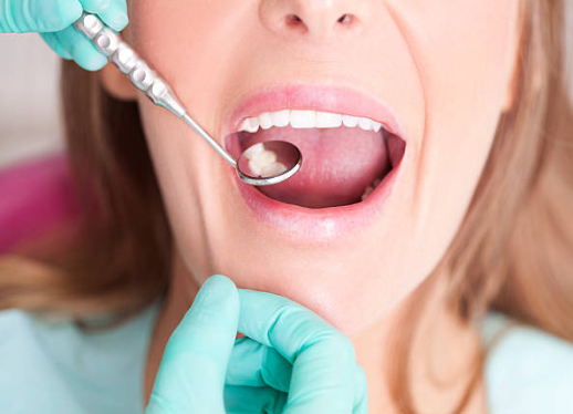 impacted canine removal